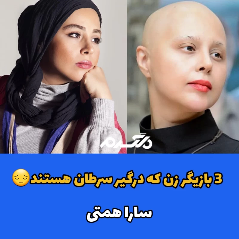 ۳ بازیگر زن که درگیر سرطان هستند