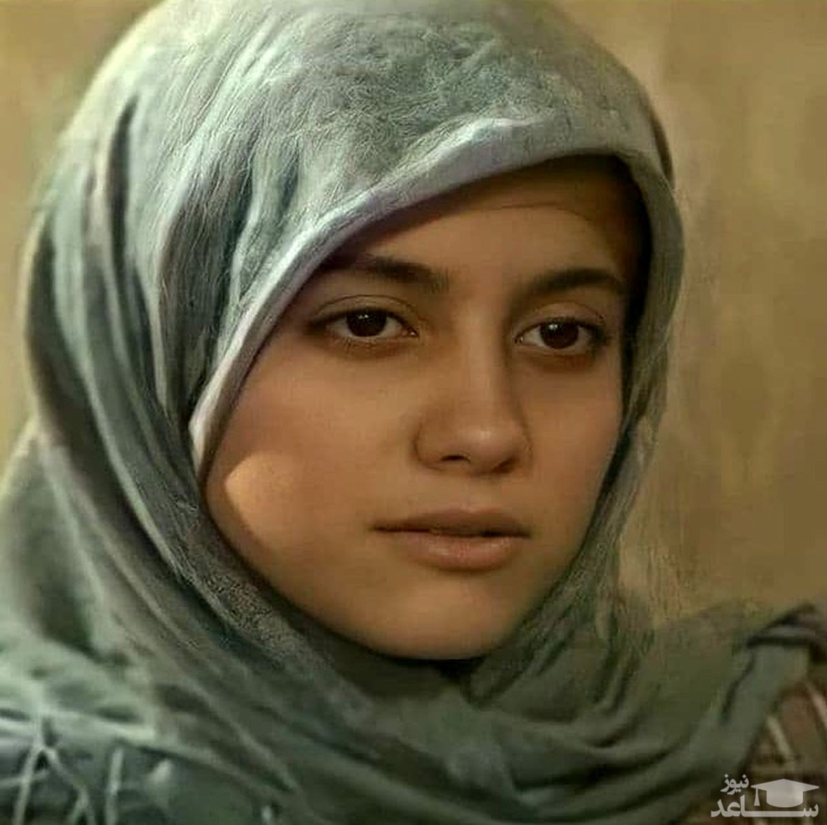 آشا محرابی قبل از عمل جراحی