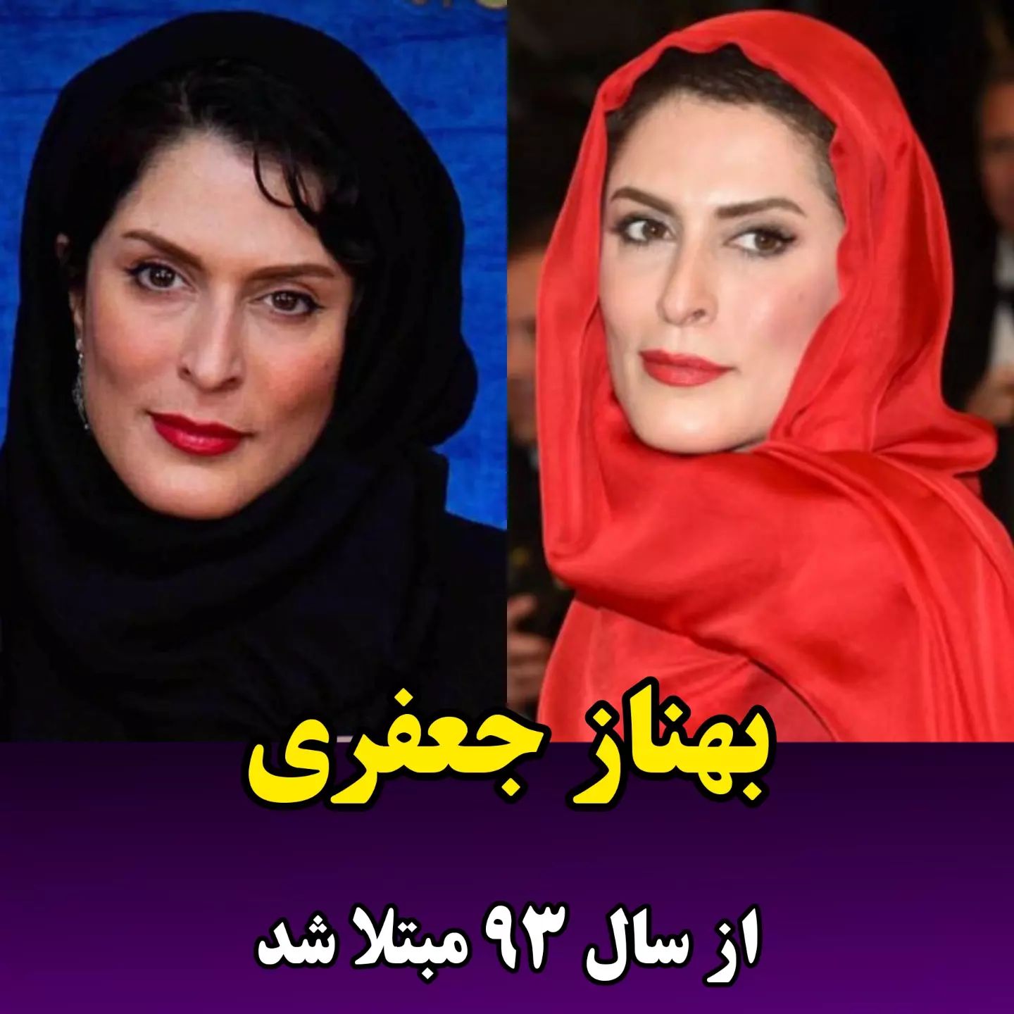 بازیگرانی که ام اس دارند