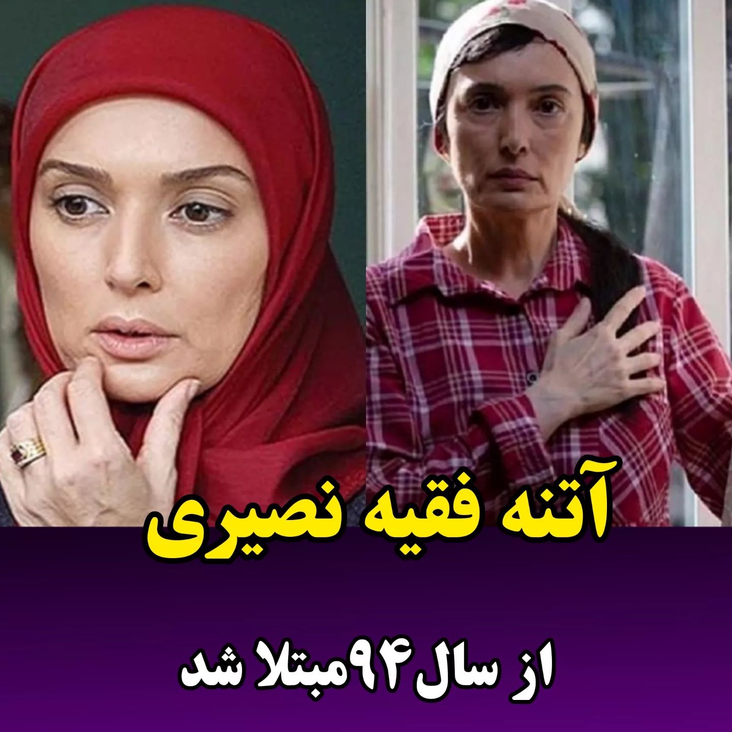 بازیگرانی که ام اس دارند