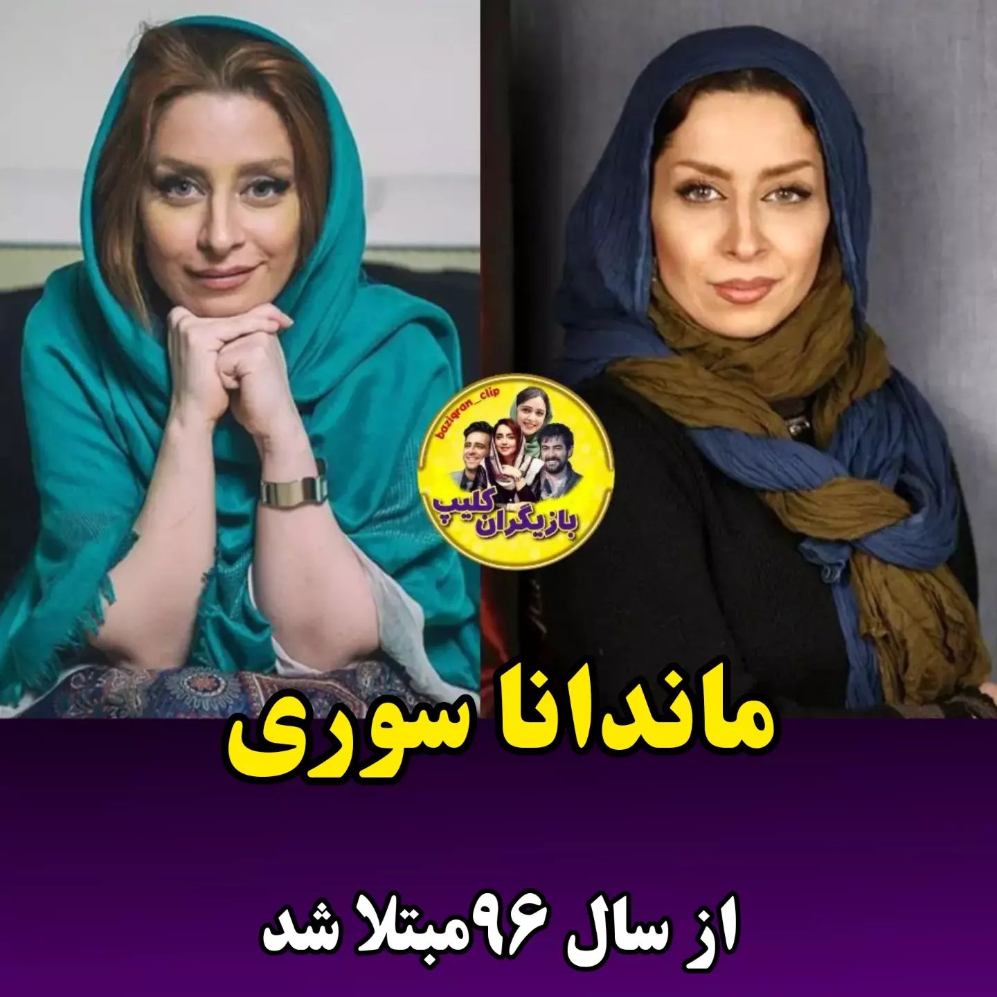 بازیگرانی که ام اس دارند