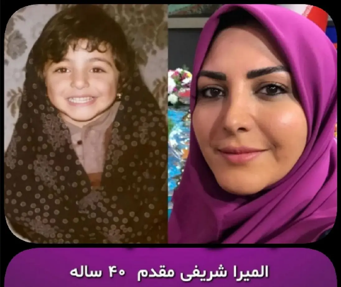 تغییر چهره باورنکردنی المیرا شریفی مقدم از 22 سالگی تاکنون ! + عکس قدیم و  جدید