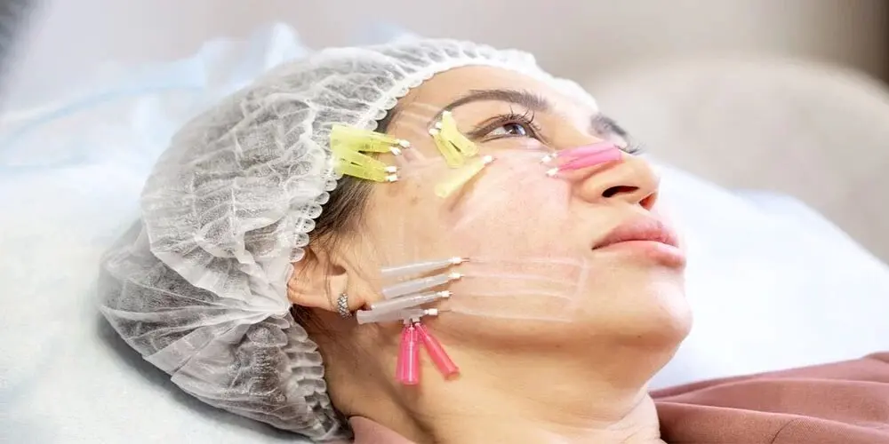 امبدینگ چیست و چطور باعث لاغری می‌شود؟