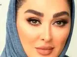 عکس های باورنکردنی از خانم بازیگران ایرانی بعد از عمل زیبایی / زشت تر از قبل شدند !