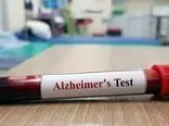 تشخیص آلزایمر تنها با یک «آزمایش خون» + فیلم