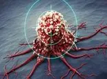 عوامل سلولی و مولکولی مؤثر در بروز سرطان خون