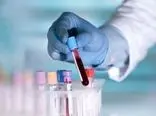 طراحی تست خون برای تشخیص زودهنگام سرطان/ درمان بر اساس ژنتیک فرد