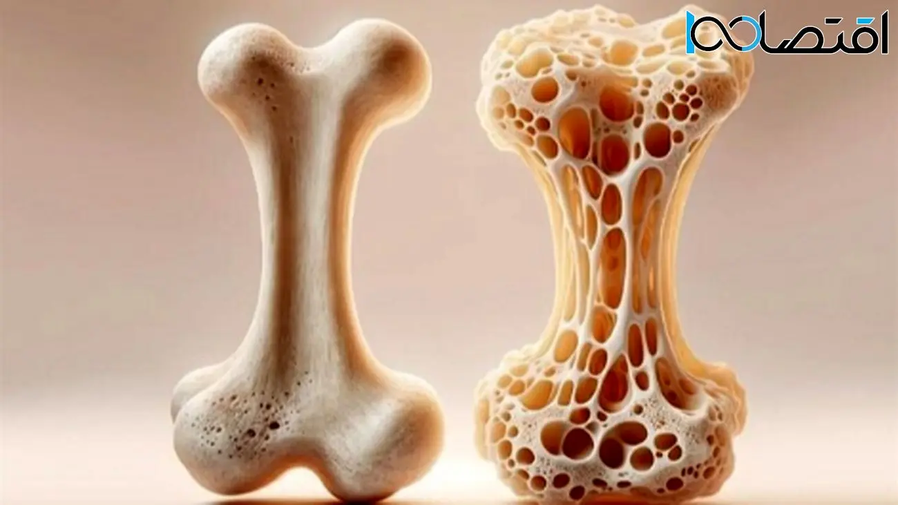 مواد غذایی شگفتانگیز برای پیشگیری از پوکی استخوان