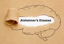 تشخیص آلزایمر با کمک آزمایش ادرار سال‌ها قبل از بروز علائم

