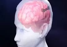 امکان استفاده از شبکه‌های اجتماعی با استفاده از ذهن برای بیماران فلج اندام