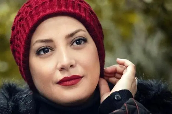 عکس‌های لو رفته از تغییر چهره عجیب طناز طباطبایی / چی بود و چی شد !