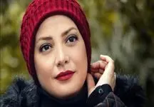 عکس‌های لو رفته از تغییر چهره عجیب طناز طباطبایی / چی بود و چی شد !