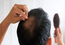 پایان ریزش مو فقط با این چند نکته ساده و اثربخش!