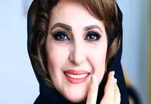 تغییر چهره ناگهانی فاطمه گودرزی در این سن و سال ! 