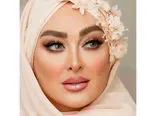عکس خیلی قدیمی و دهه هشتادی از الهام حمیدی / خانم بازیگر را قبل از عمل زیبایی ببینید !
