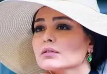 ژست پسرکش سانیا سالاری در مطب دکتر زیباییش / چه تیپی زد خانم بازیگر !