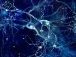 کالبدشکافی مغز مبتلایان به آلزایمر یک عامل احتمالی جدید را برای این بیماری نشان داد