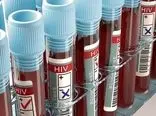 برای پنجمین‌بار در تاریخ؛ یک بیمار مبتلا به HIV با پیوند سلول‌های بنیادی درمان شد