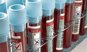 برای پنجمین‌بار در تاریخ؛ یک بیمار مبتلا به HIV با پیوند سلول‌های بنیادی درمان شد