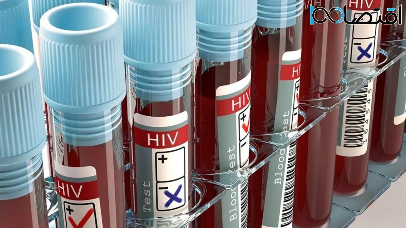برای پنجمین‌بار در تاریخ؛ یک بیمار مبتلا به HIV با پیوند سلول‌های بنیادی درمان شد