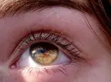 تغییری مخفی در چشمان شما می‌تواند اولین علامت کاهش شنوایی باشد