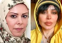 تغییر چهره باورنکردنی فلور نظری بعد از بازگشت به ایران / 180 درجه زیر و رو شد !