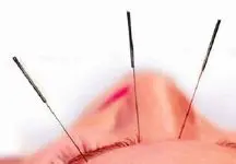 با سوزن وزن کم کنید