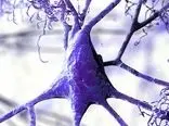 علت آلزایمر در ماده سفید مغز ما کشف شد