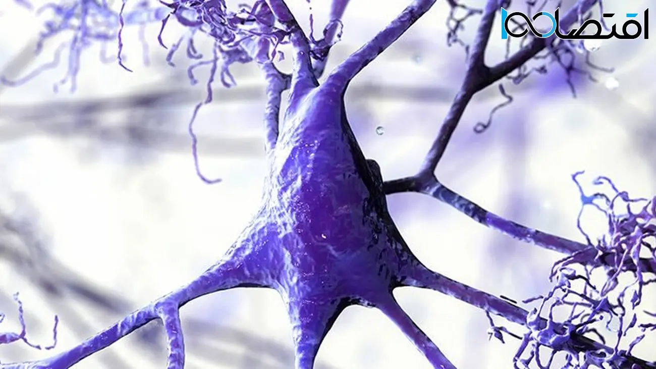 علت آلزایمر در ماده سفید مغز ما کشف شد