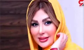 این خانم بازیگران ایرانی معتاد عمل زیبایی هستند ! + اسامی و جزئیات جراحی ها پلاستیک !