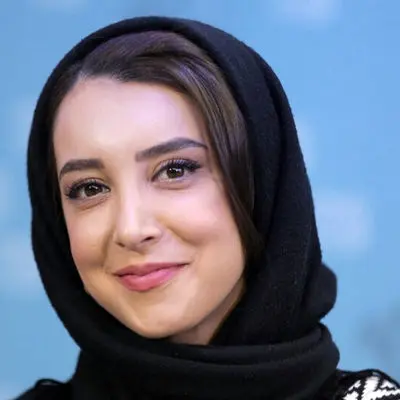بلایی که پزشک سرشناس ایرانی بر سر این خانم بازیگر آورد / زیبایی چهره اش نابود شد !