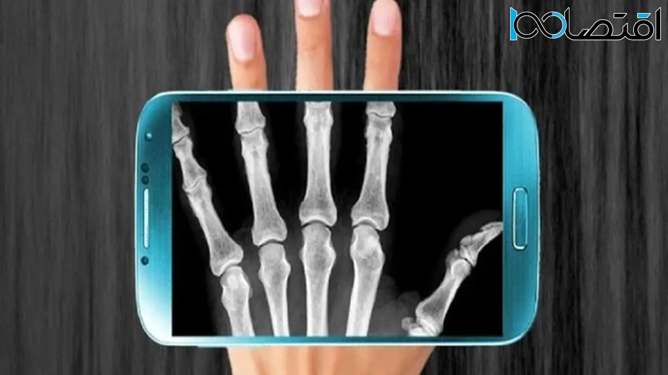 رادیولوژی روی موبایل با تراشه جدید