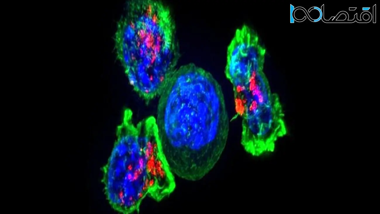 کشف روش جدید و غیرمنتظره سلول‌های سرطانی برای متاستاز
