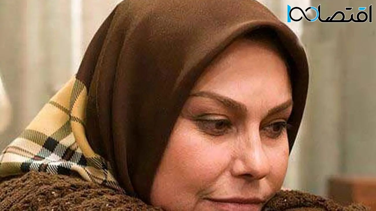 عکس چهره باورنکردنی از قبل و بعد عمل خانم بازیگران ایرانی ! 