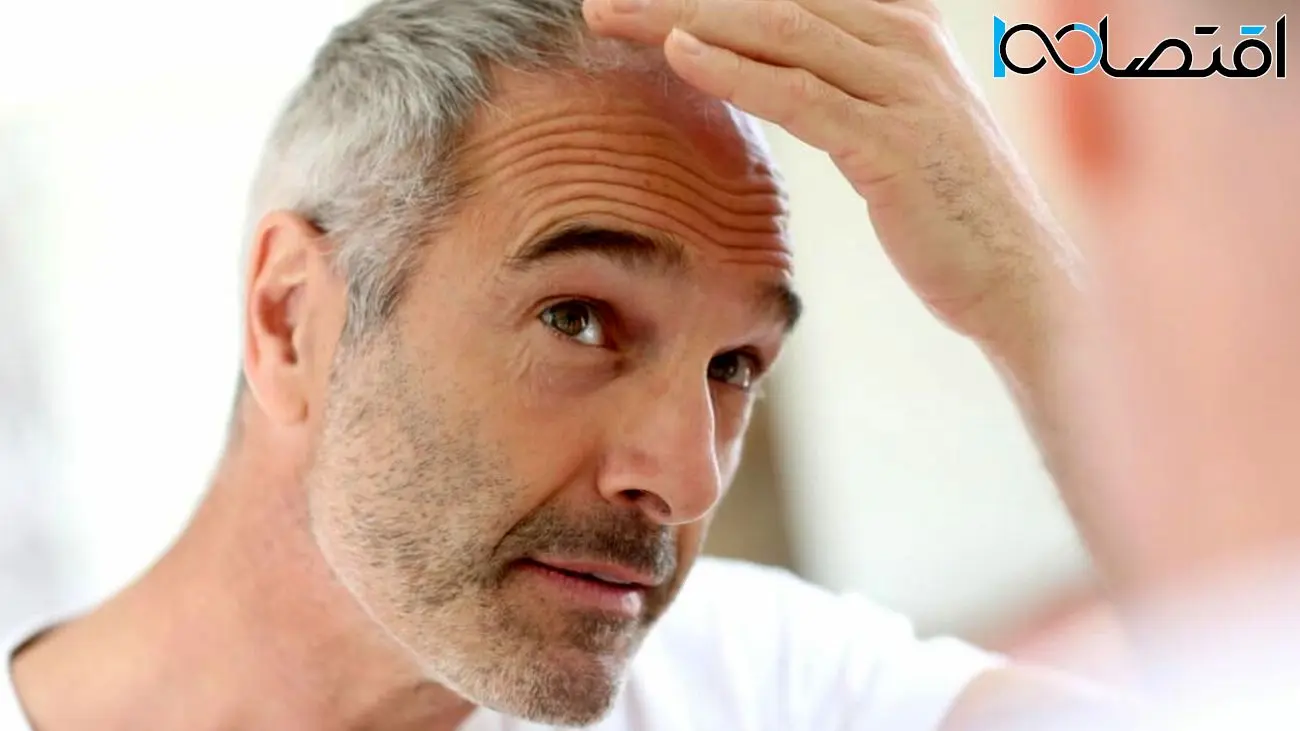 دانشمندان به راهکار احتمالی جدیدی برای جلوگیری از سفید شدن مو دست یافتند