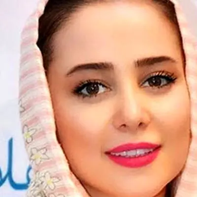 الناز حبیبی در گذر زمان / قبل از انجام عمل های زیبایی! + عکس 