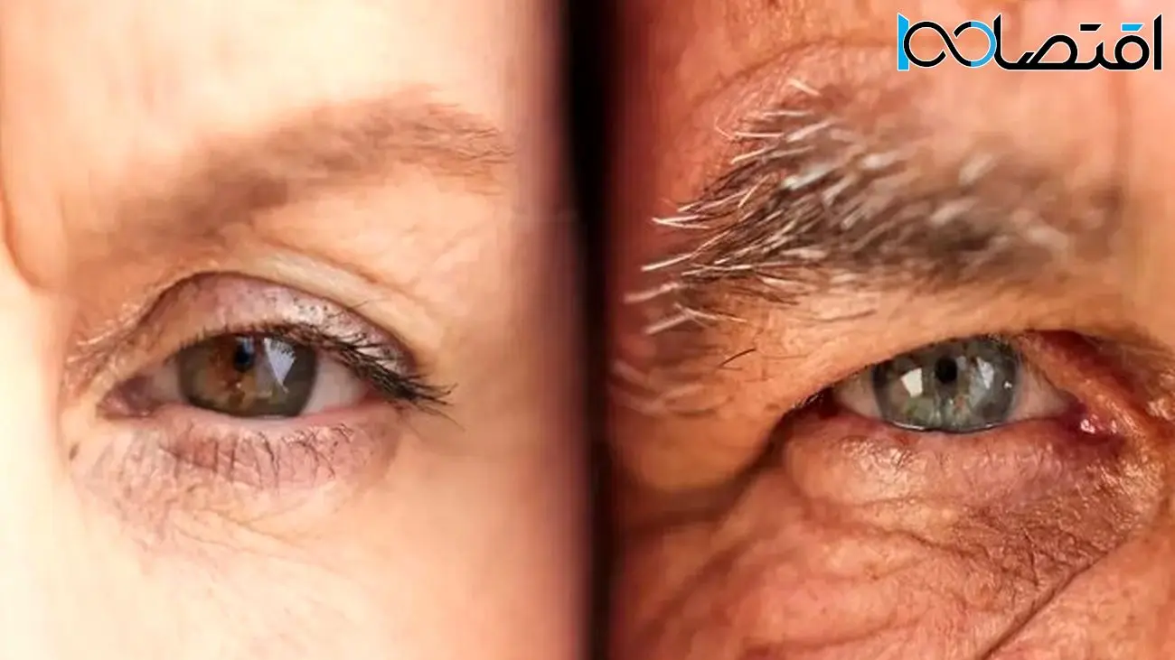 کند کردن پیری توسط محققان آلمانی