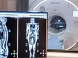هزاران نفر برای روش جدید اسکن سرطان صف بستند؛ 2500 دلار در ازای MRI کامل بدن