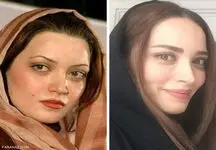 چرا بهنوش طباطبایی یک شبه پیر و تکیده شد!