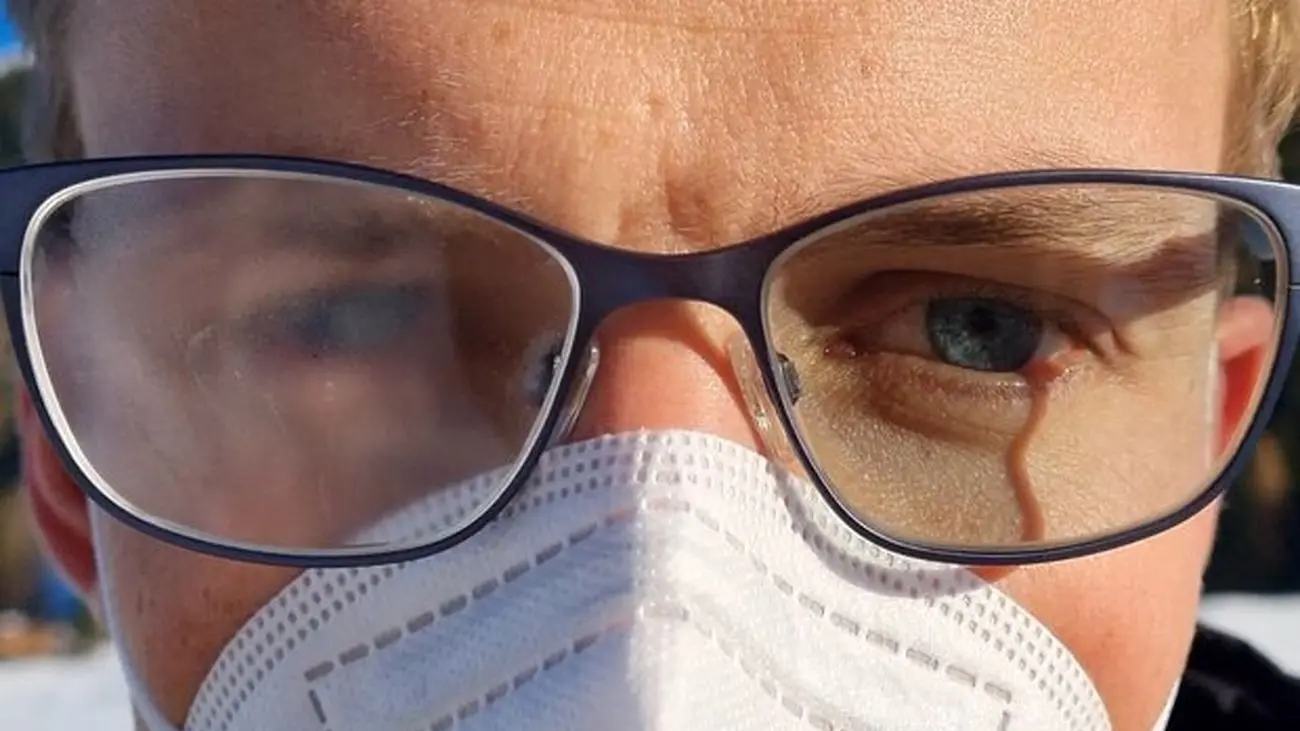 نانو ذرات طلا از مه گرفتگی عینک جلوگیری می کنند