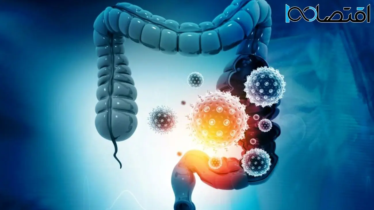 نتایج امیدوارکننده در درمان یک نوع سرطان روده؛ بهبود 62 درصد از بیماران با یک قرص جدید