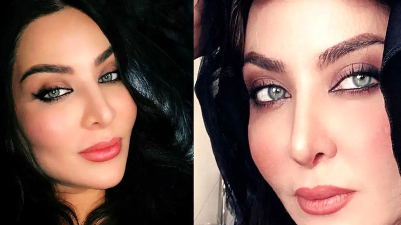 از دیدن چهره قبل از عمل فقیهه سلطانی حیرت می کنید + عکس قبل و بعد جراحی