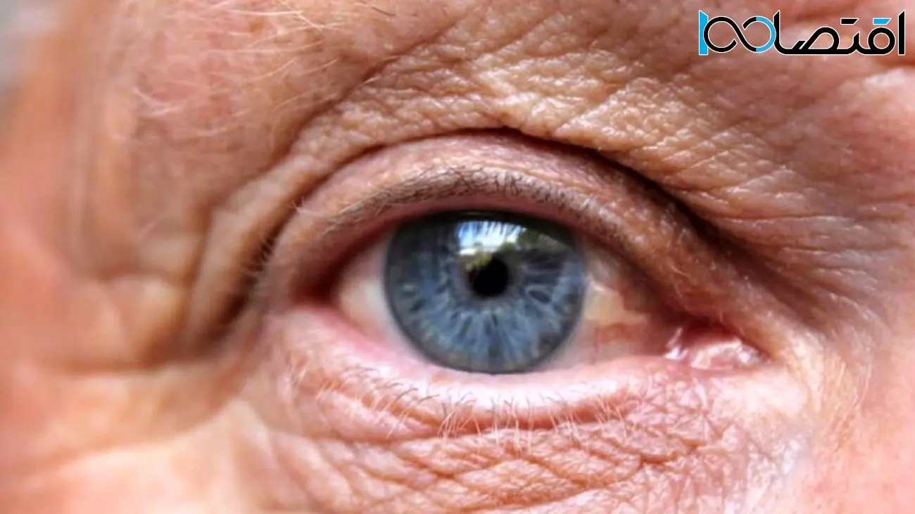 امیدی تازه برای درمان نابینایی: دانشمندان با فناوری نانو موفق به پرورش سلول‌های چشم شدند