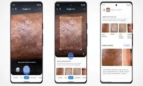 گوگل لنز به کمک هوش مصنوعی، دکتر پوست می‌شود و کار مزون‌های لباس را انجام می‌دهد