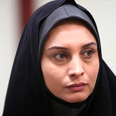 عکس غیر قابل باور از چهره مریم کاویانی/ خانم بازیگر کوبیده از نو ساخته ! 