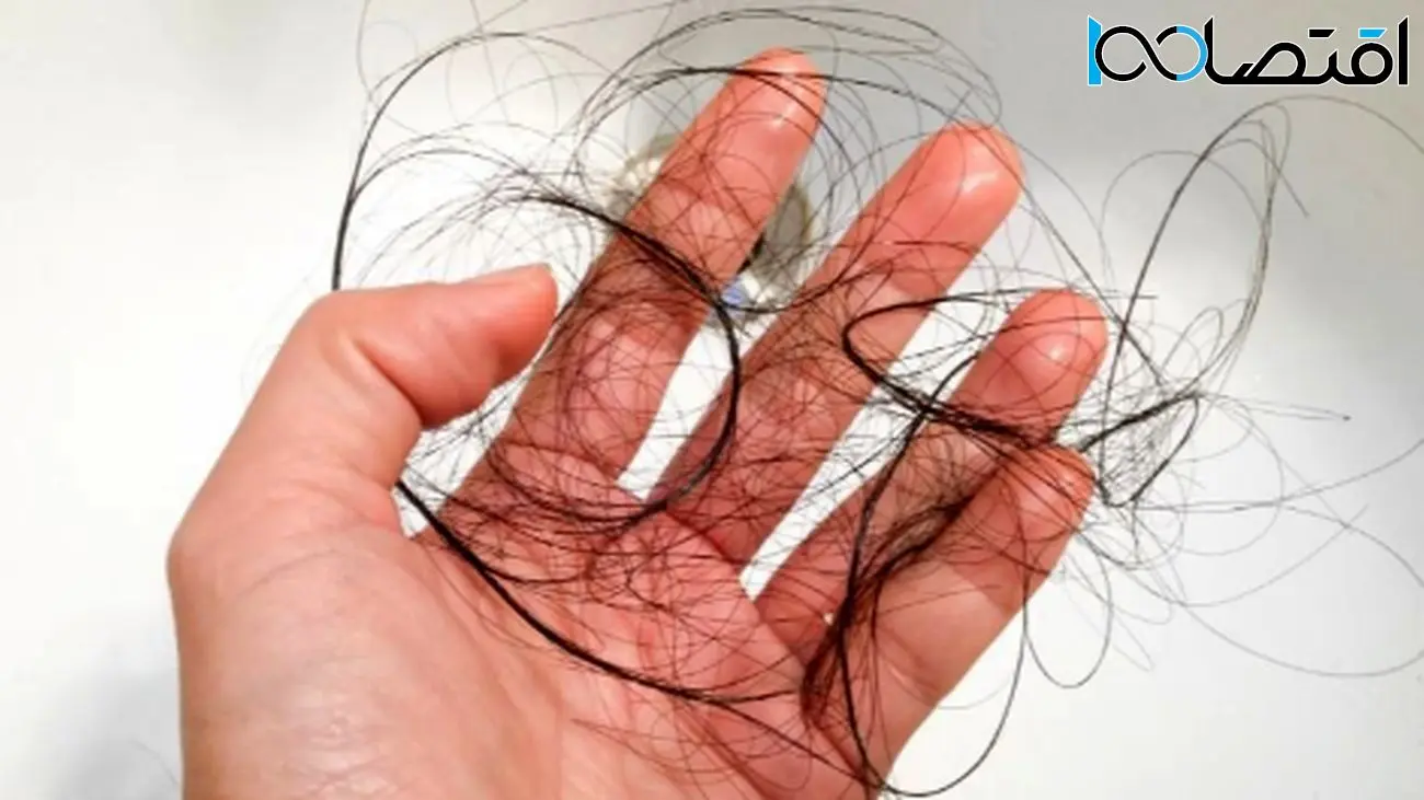 این کارهای ساده ریزش مو را کاهش میدهند