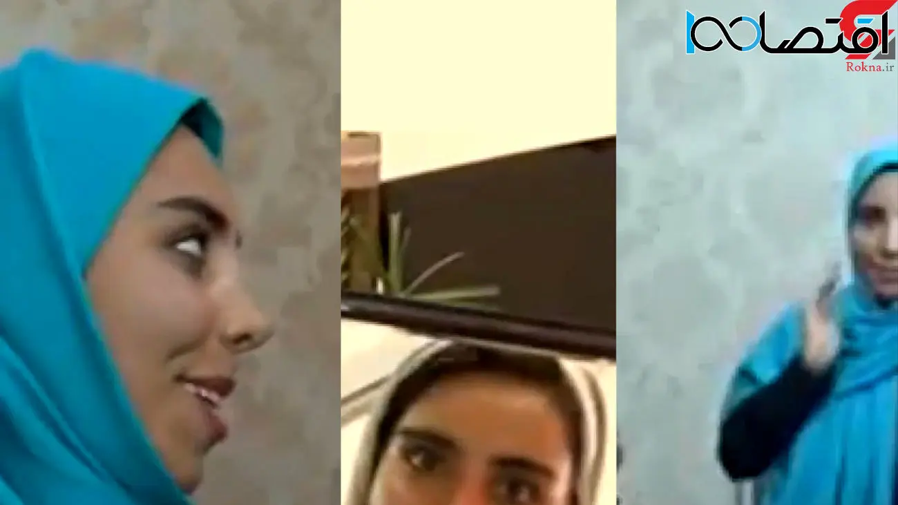 فیلم معجزه جراحی پلاستیک در صورت زشت ترین دختر ایرانی ! 