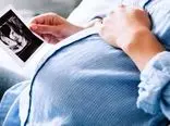 عکس عجیب ترین زایمان یک زن در دنیا / بدون حاملگی مادر شد !