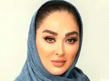 عجیب ترین تغییر چهره عروسکی الهام حمیدی / 6 عکس از خانم بازیگر بعد از عمل زیبایی !