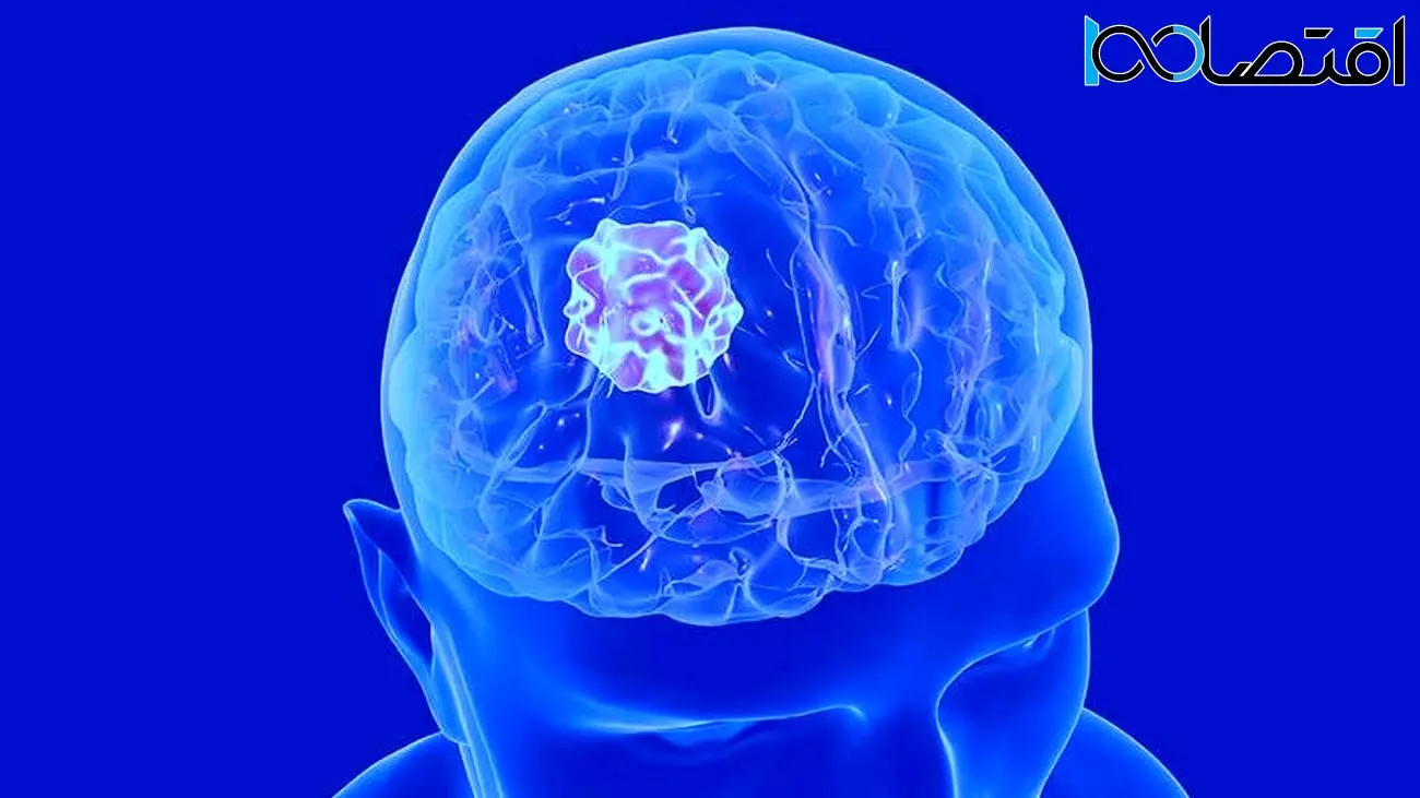 توسعه ابزار کوچکی که می‌تواند هم‌زمان بیش از ۲۰ درمان را برای سرطان مغز تست کند